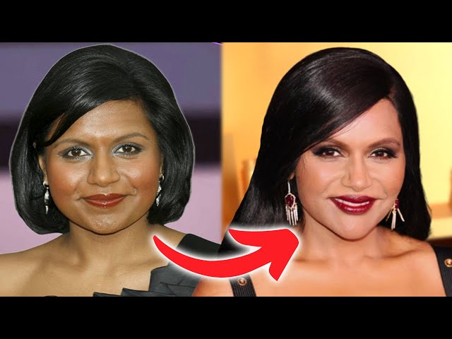 Mindy Kaling's New Look; Ozempic and Plastic Surgeries?