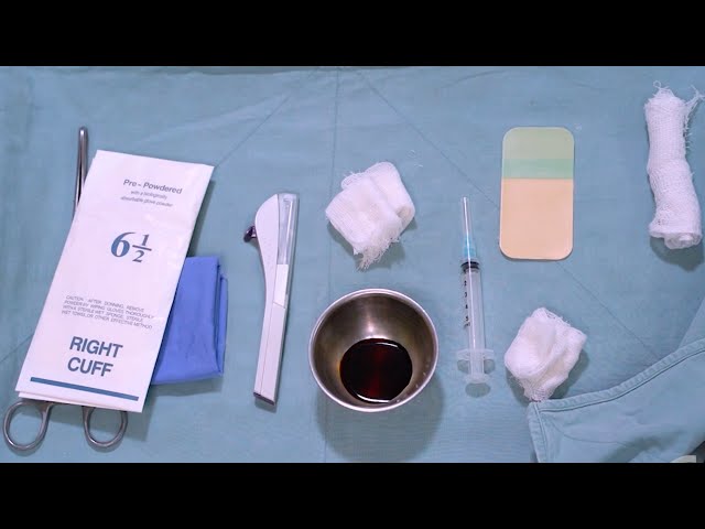Setting up for Implant Procedures (Health Workers), Spanish - Family Planning Series