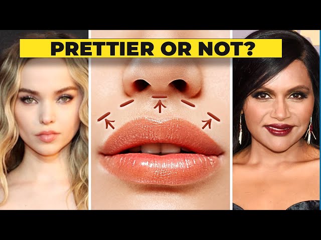The Lip Lift: BEAUTIFYING Procedure or Scam?