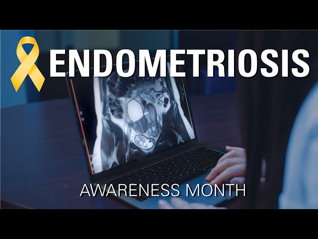 Endometriosis Awareness Month Featuring Courtney Lim, MD