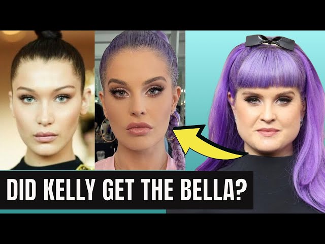 Kelly Osbourne: Weight Loss or Plastic Surgery - The Truth Unveiled