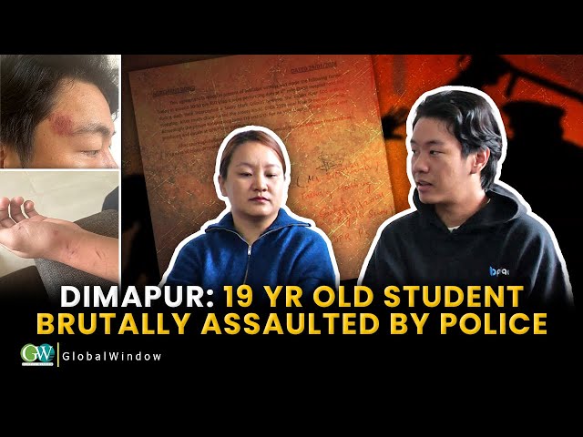 DIMAPUR : 19 YR OLD STUDENT  BRUTALLY  ASSAULTED BY POLICE