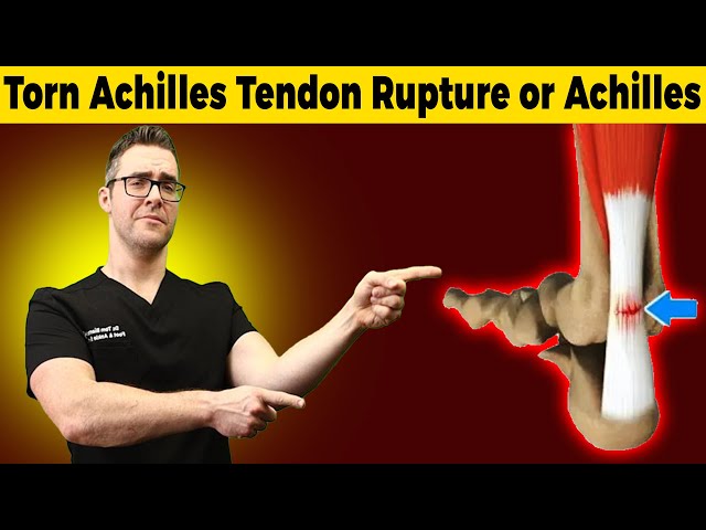 Torn Achilles Tendon Rupture or Achilles Tendonitis? [HOW TO TELL]