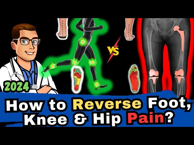 How To Reverse Foot, Knee & Hip Pain with Orthotics & Insoles FAST
