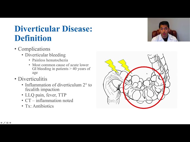 Diverticular Disease - Diagnosis, Complications and Management