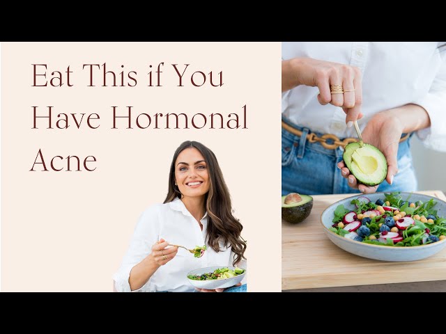 Eat This if You Have Hormonal Acne