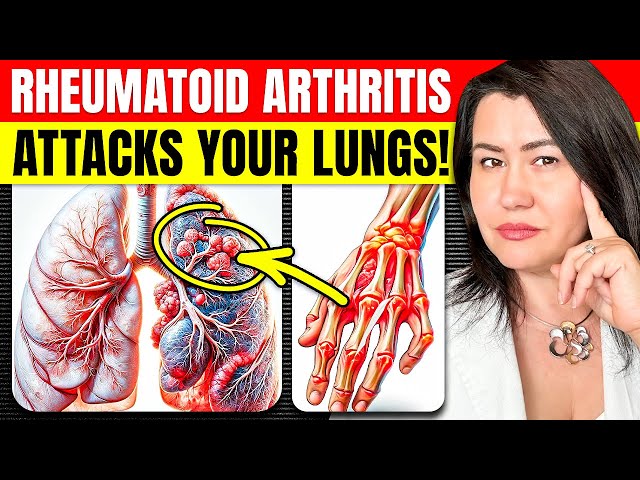 Warning: Rheumatoid Arthritis And Lung Problems