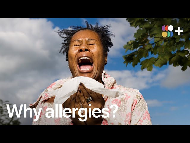 Who Gets Allergies?