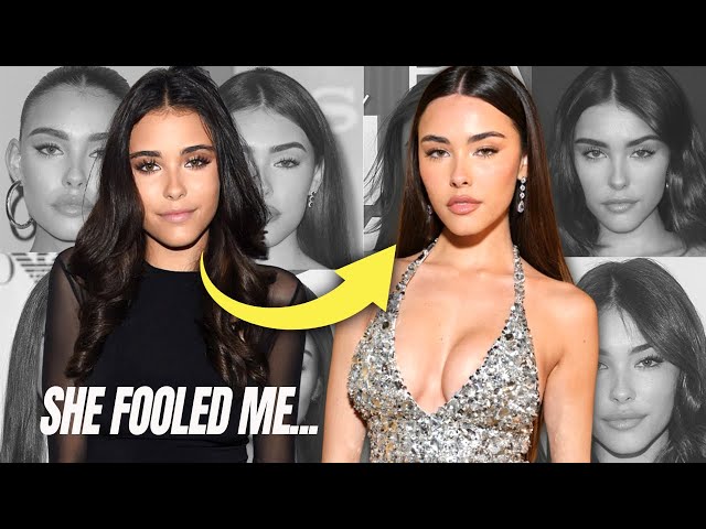 NEW Madison Beer Plastic Surgery Update:: What I Didn't See The First Time...