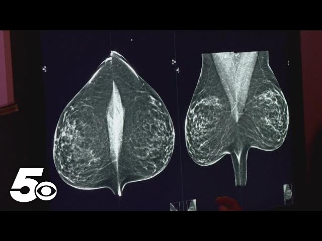 Here's 4 things a radiologists look for in a mammogram