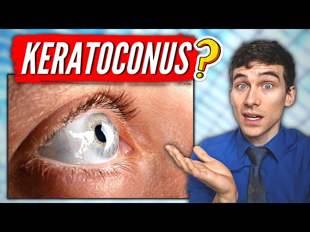 What is Keratoconus? (Keratoconus Eye Disease Explained)