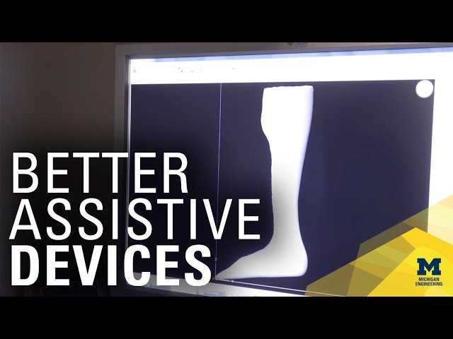 Using 3D printing to speed up orthotic and prosthetic production