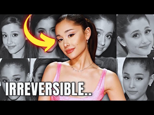 What "HAPPENED" to Ariana Grande's EYES? - Plastic Surgery Analysis