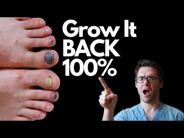 How Long Does It Take for Nails To Grow Back After Falling Off?
