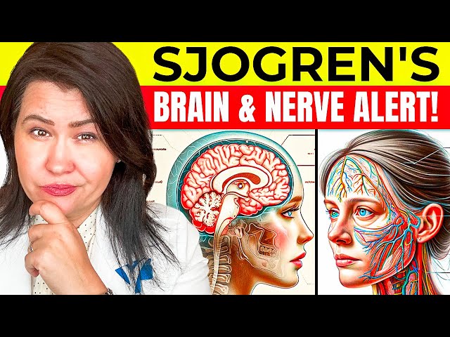 How Sjogren's Can Influence Your Brain and Nerves