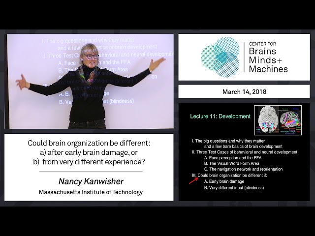 8.10 - Could brain organization be different: a) after early brain damage, or b)...
