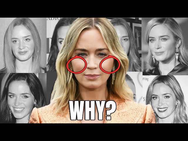 The Reason Behind Emily Blunt's HUGE Face Change: 2023 Plastic Surgery Analysis