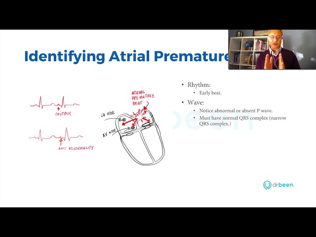 Atrial and Junctional Premature Beats - EKG Interpretation