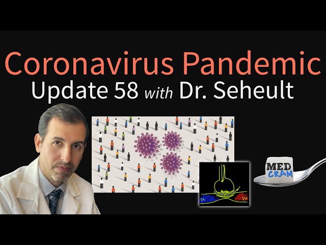 Coronavirus Pandemic Update 58: Testing; Causes of Hypoxemia in COVID-19 (V/Q vs Shunt vs Diffusion)