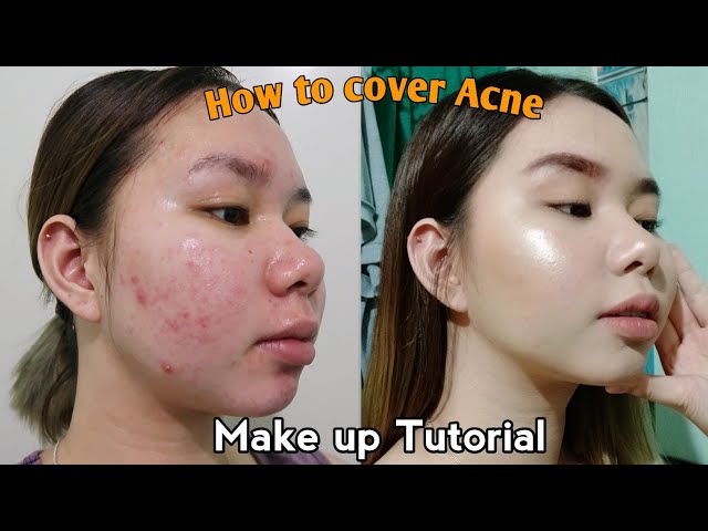 MAKE UP Tutorial for ACNE prone skin | My Everyday Make up routine ✨