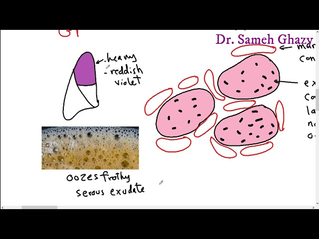 Systemic pathology 13 : respiratory system 1 ( pneumonia and lung abscess) DR.SAMEH GHAZY