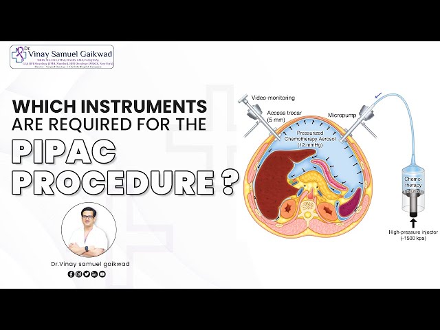 Which Instruments Are Required For the PIPAC Procedure? | Dr Vinay Samuel Gaikwad #cancer #PIPAC