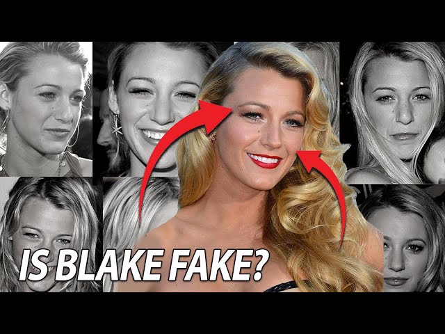 Blake Lively's Plastic Surgery: Not as Natural as You Think ...