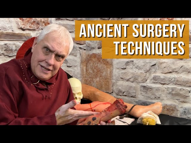 Ancient Surgery Techniques | Repairing Wounds & Surviving Pain