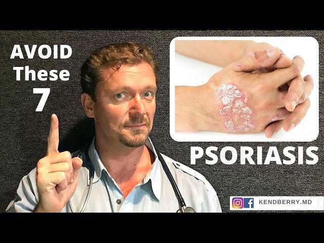 PSORIASIS (AVOID These 7 Things) 2024