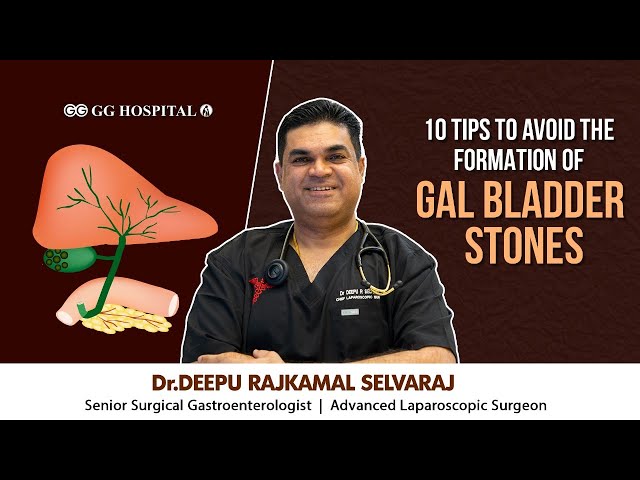 10 TIPS TO PREVENT GALLBLADDER STONE FORMATION!!- DR DEEPU RAJKAMAL SELVARAJ - GG HOSPITAL #gb stone