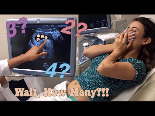FIRST ULTRASOUND and it’s HOW MANY?
