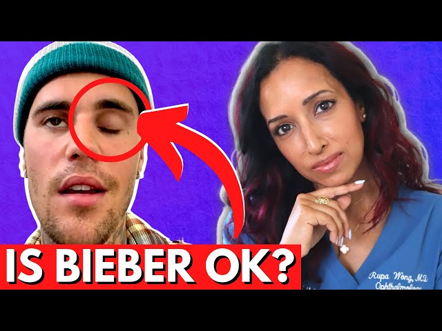 Eye Doctor Explains Justin Bieber's Facial Paralysis