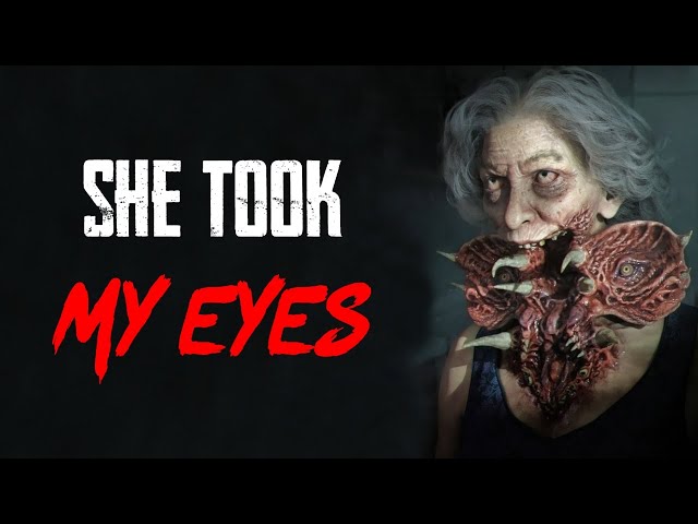 "They Took My Eyes" | Creepypasta | Horror Story