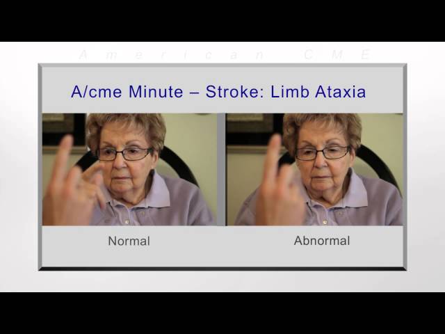 Stroke- limb ataxia