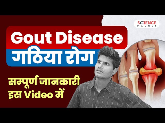 Gout Disease (गठिया रोग) सम्पूर्ण जानकारी इस Video में | कारण, लक्षण एवं इलाज #neerajsir