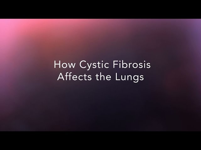 How Cystic Fibrosis Affects the Lungs