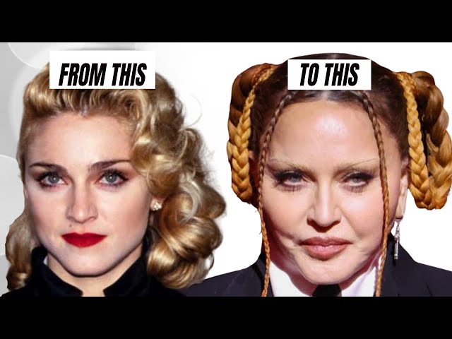 Madonna: Plastic Surgery - Lorry Hill