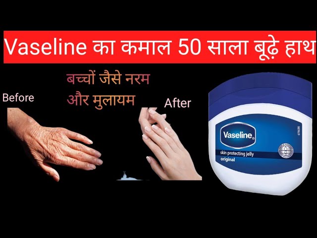 How I keep my hands Soft And wrinkles Free, 😱💯 | Best Natural Home Remedies For Wrinkles🔥