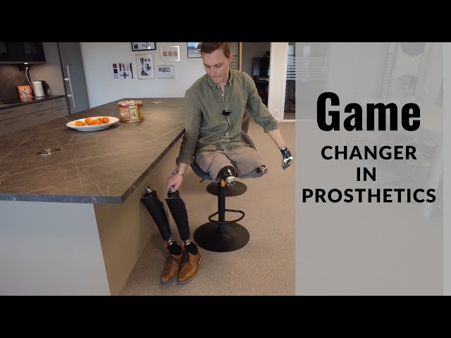 Game Changer in Prosthetics - by Triple Amputee Christoffer Lindhe