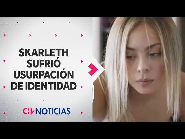 Skarleth Labra se desahogó por falso perfil en OnlyFans y suplantación de identidad - CHV Noticias
