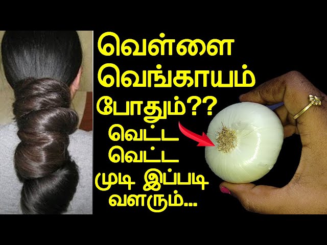 1 வெள்ளை வெங்காயம் போதும் முடி இப்படி வளரும் | hair growth tips in tamil | long hair tips in tamil