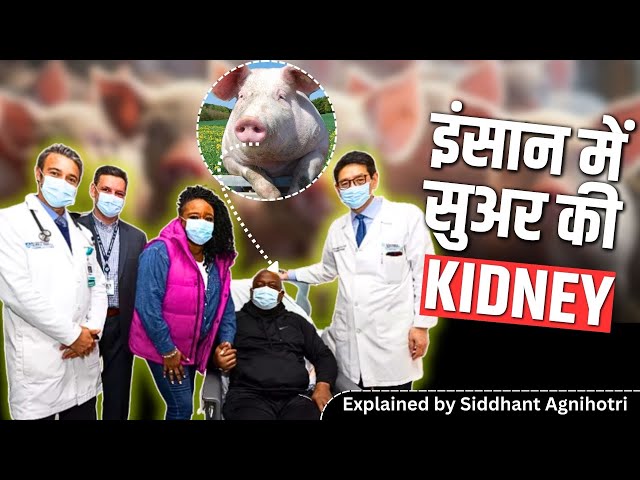 How Pig kidney transplantation is done in humans?