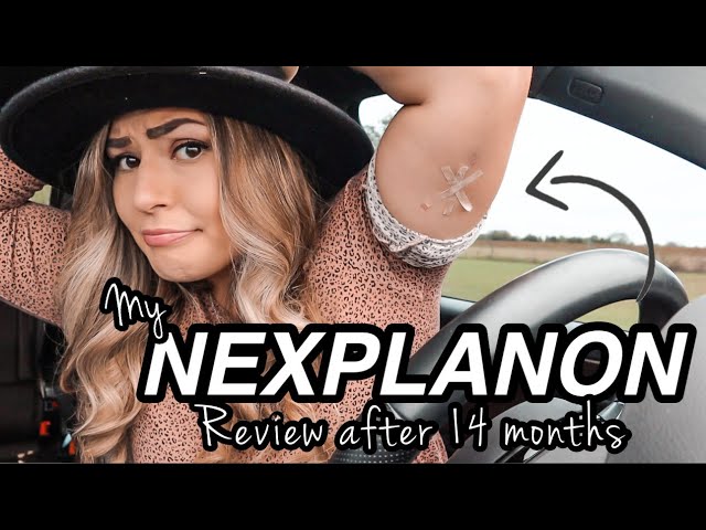 ONE YEAR on Nexplanon Birth Control Implant | side effects, removal