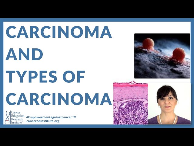 #11 | What is CARCINOMA? | Cancer Education and Research Institute