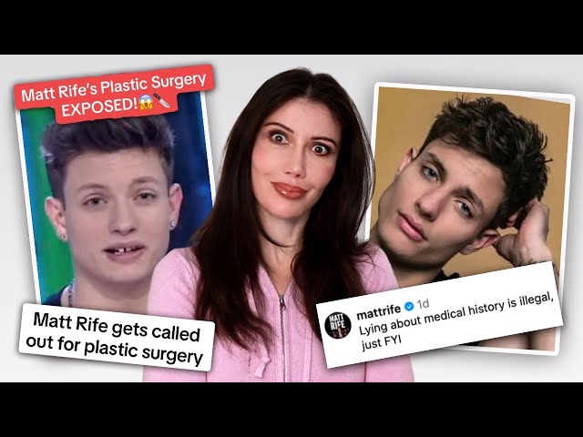 Matt Rife's SECRET Jaw Surgery? | Are Facial Implants, Veneers and Fillers REALLY the Cause?