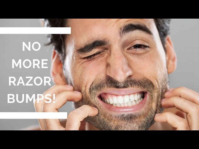 How To Stop Razor Bumps and Ingrown Hair Easy And Naturally