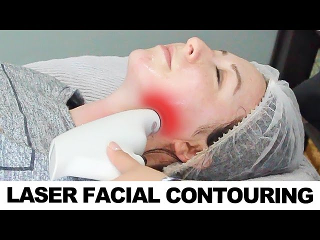 Laser Facial Contouring - Alma Accent Body and Face Contouring