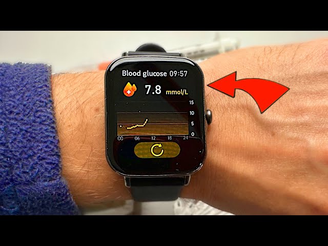 I Tried a Non-Invasive Blood Sugar Watch. Miracle or Scam?