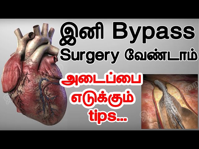 இனி open heart surgery பண்ண வேண்டாம் |  Iyarkai murai | Heart Attack | Maradapippu | Bypass | BP