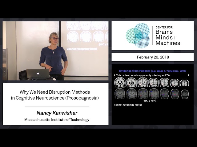2.13 - Why We Need Disruption Methods in Cognitive Neuroscience (Prosopagnosia)